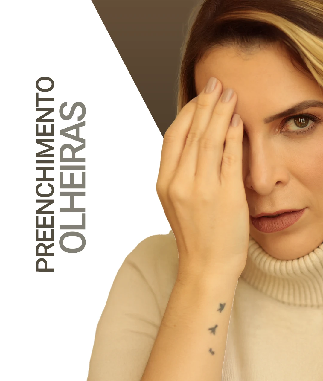 Antes e depois do preenchimento de olheiras na Clínica Dra. Juliana Beani jundiai - Aplicação de ácido hialurônico para olheiras