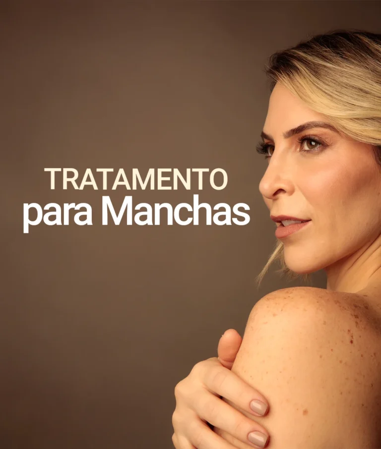 Antes e depois do tratamento a laser para manchas na Clínica Dra. Juliana Beani Aplicação de laser para clareamento de manchas na pele