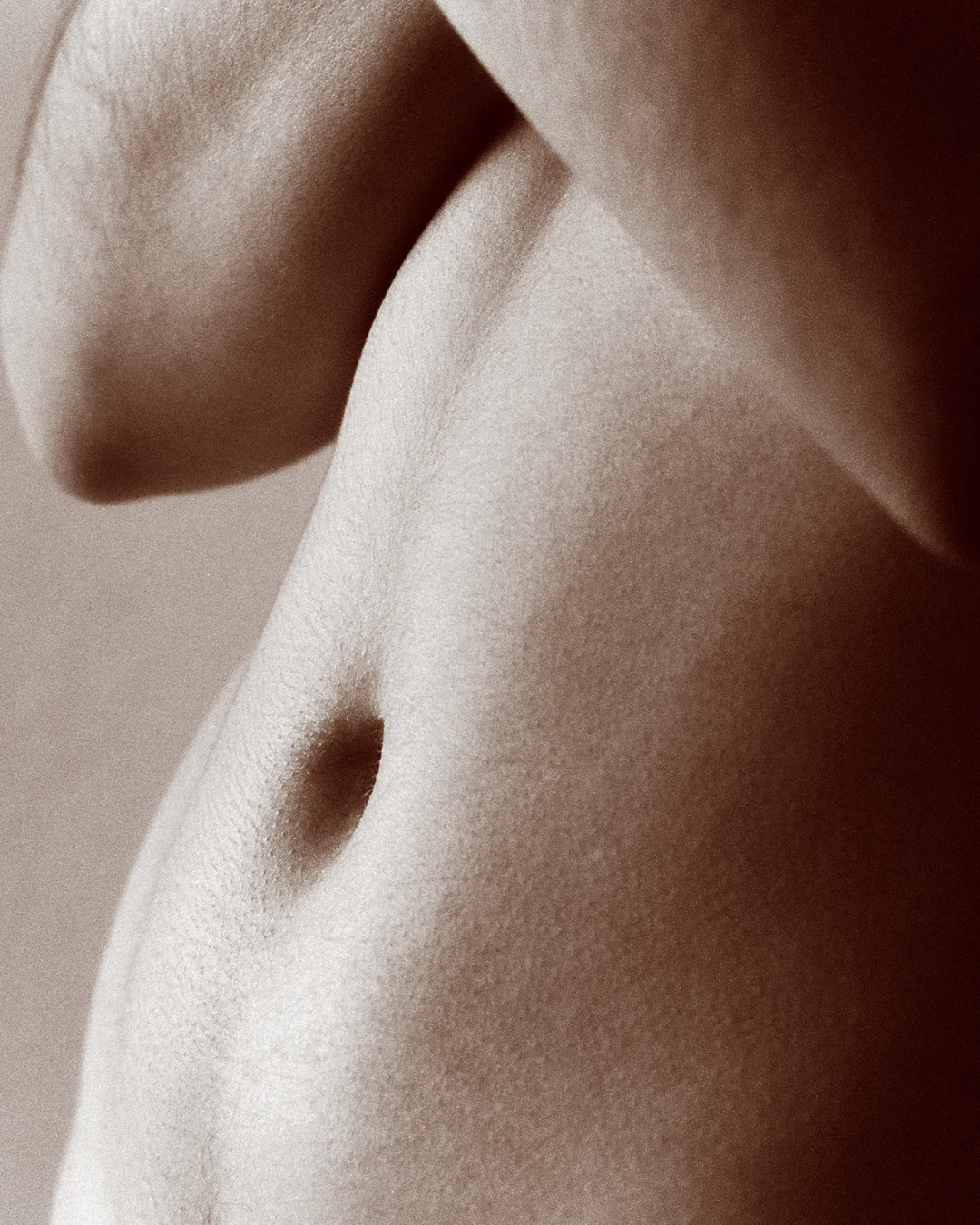 Abdômen inferior e superior com criolipolise e criusculpt dra juliana beani jundiai sp