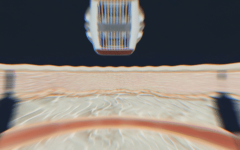 CollFase 1 Criolipólise em Jundiaí, Criolipólise, Criolipólise Preço, Criolipólise Funciona, Criolipólise antes e depois, criolipólise como funciona, Criolipólise Jundiaí, criolipólise riscos y5at0eaadno Criolipólise em Jundiaí, Criolipólise, Criolipólise Preço, Criolipólise Funciona, Criolipólise antes e depois, criolipólise como funciona, Criolipólise Jundiaí, criolipólise riscos