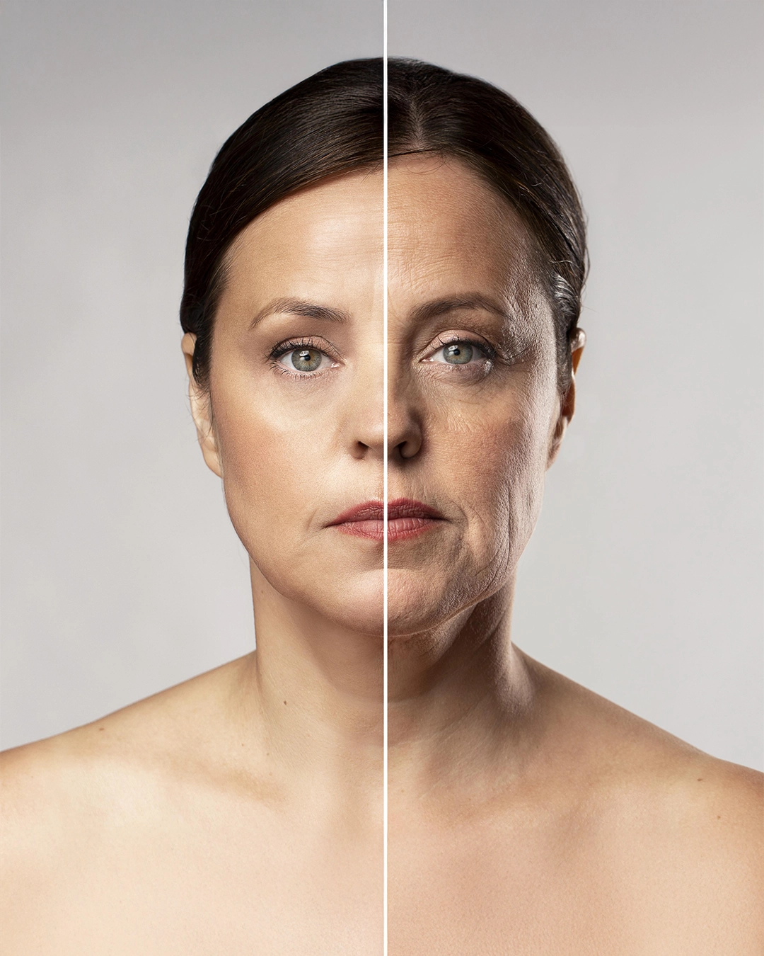 Skinbooster jundiai Criolipólise em Jundiaí, Criolipólise, Criolipólise Preço, Criolipólise Funciona, Criolipólise antes e depois, criolipólise como funciona, Criolipólise Jundiaí, criolipólise riscos