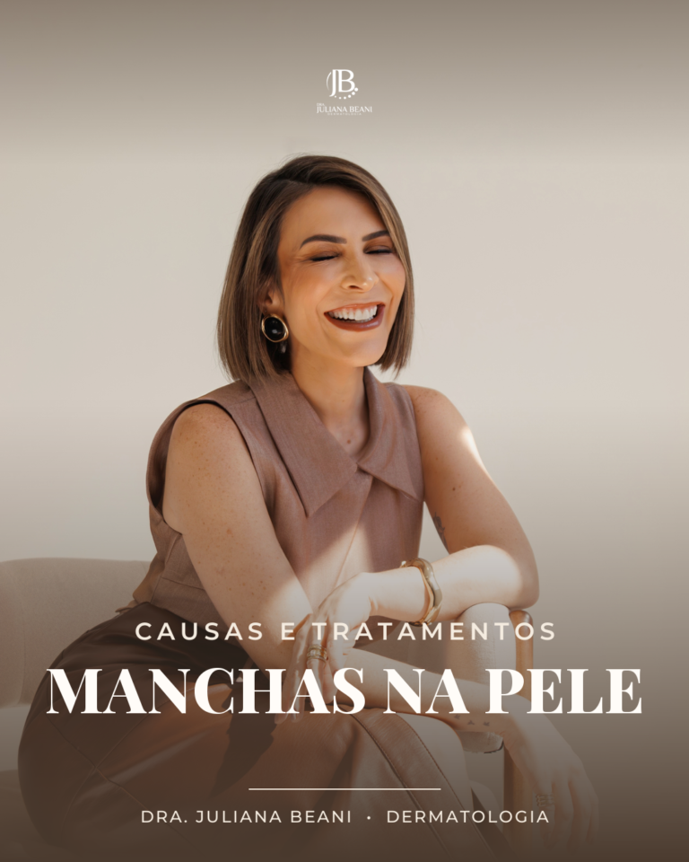 Manchas na Pele: Quais São as Causas e os Tratamentos Mais Eficazes para Cada Tipo